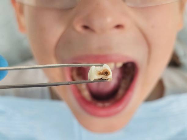 Best Emergency Treatment for Dental Infections or Abscesses in Kouts, IN